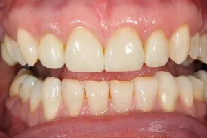 Smile gallery case 4 - After