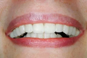 Smile gallery case 5 - After