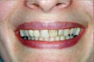 Smile gallery case 5 - Before